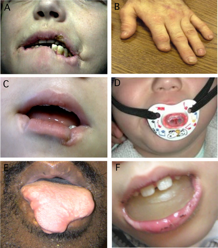 Mouth and Teeth: MedlinePlus