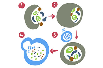 Autophagy in Parkinson’s disease Autophagy in Parkinson’s disease